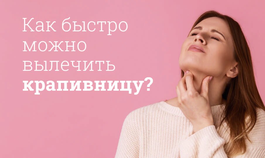 Крапивница: лечение, симптомы и причины